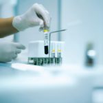 NIFTY teszt: a legpontosabb Down-szindróma szűrés terhesség alatt